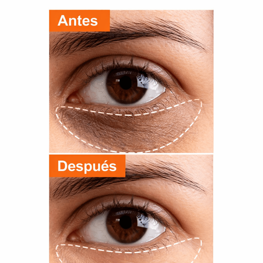 SADOER Retinol - Despídete de las Ojeras y Bolsas en Minutos