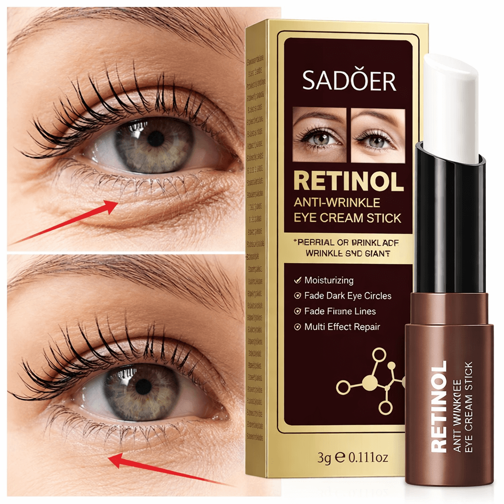 SADOER Retinol - Despídete de las Ojeras y Bolsas en Minutos